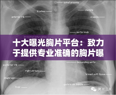 十大曝光胸片平台：致力于提供专业准确的胸片曝光信息