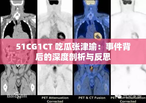 51CG1CT 吃瓜张津瑜：事件背后的深度剖析与反思